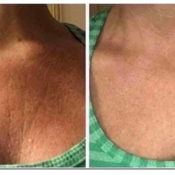 Nuskin’s best seller: the hibiscus and honey firming cream is available now. - Picture 11 of 11